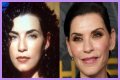 Julianna Margulies Doesn’t Look Natural After Plastic Surgery!